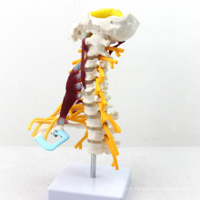 VERTEBRA02 (12385) Modèle de muscle et de nerf cervical grandeur nature de luxe de science médicale, modèles vertébral / vertèbre&gt; Vertèbre cervicale